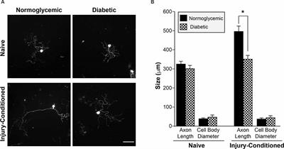 Failure to Upregulate the RNA Binding Protein ZBP After Injury Leads to Impaired Regeneration in a Rodent Model of Diabetic Peripheral Neuropathy